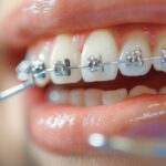 Best Orthodontist in Pune