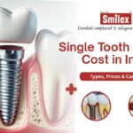 Dental Implant