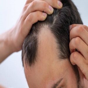 PRP Hair Treatment (1)