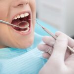 Tooth Extraction