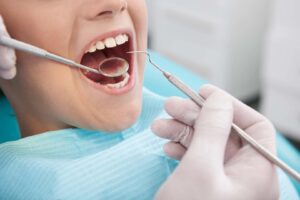 Tooth Extraction