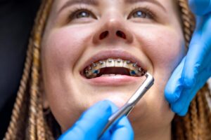 Braces Treatment in Pune