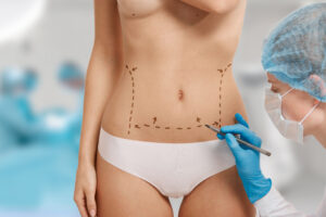 Brazilian Butt Lift Surgery in Istanbul