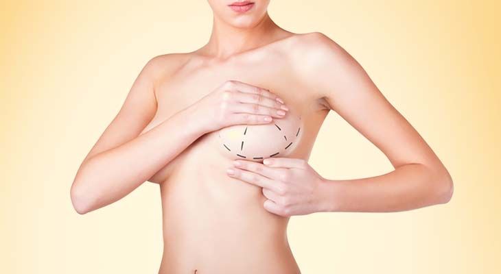 Breast Reduction in Dubai: Long-Term Results and Maintenance Tips