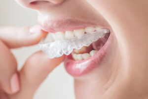 Smiling woman with silicone trainer close up.