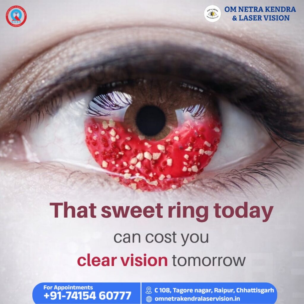 Best Squint Surgery in Raipur