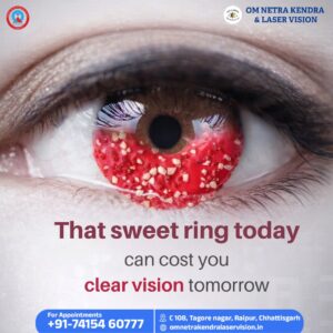 Best Squint Surgery in Raipur