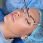 Blepharoplasty In Dubai