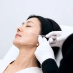 Endolift-uses-precise-laser-energy-beneath-the-skin-for-lifting-and-skin-tightening