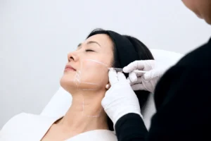 Endolift-uses-precise-laser-energy-beneath-the-skin-for-lifting-and-skin-tightening