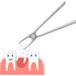 Tooth Extraction
