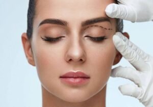 Upper Blepharoplasty In Dubai