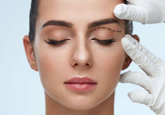 Upper Blepharoplasty In Dubai