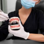 Dental implants