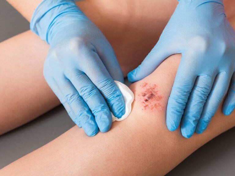 wound care in oakland
