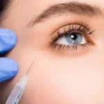 Can Under Eye Fillers Smooth Tired-Looking Eyes