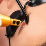 How Does Laser Tattoo Removal Fade Old Tattoos