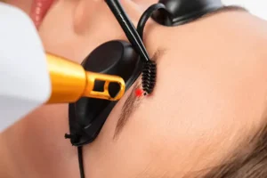 How Does Laser Tattoo Removal Fade Old Tattoos