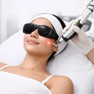 How Does Pico Laser Treatment Improve Skin Tone