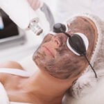How Laser Carbon Peel Improve Skin Texture