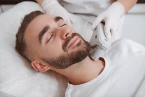Is Beard Laser Hair Removal Right for You