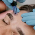 Is Exosomes Therapy Good for Skin Rejuvenation