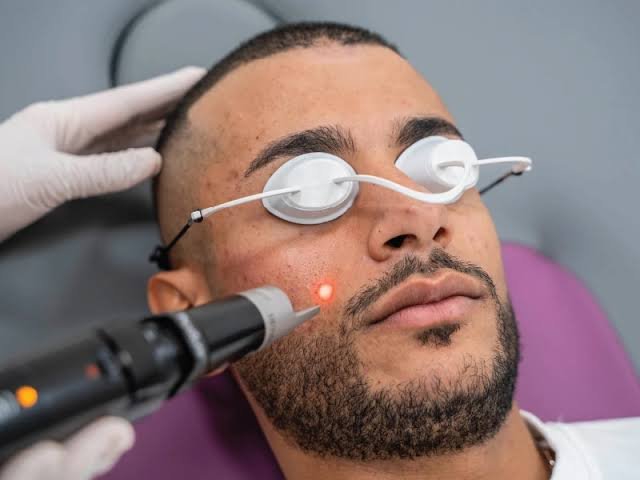 Is Pico laser treatment suitable for different skin types