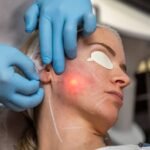 What Can Endolift Do for Sagging Skin