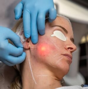 What Can Endolift Do for Sagging Skin
