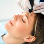 What Does Microneedling Treatment Do for Pores