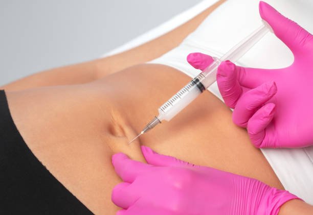 What can Fat-Dissolving Injections do for body shape