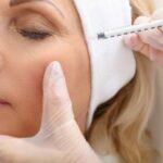 Botox in Manchester
