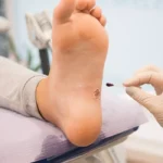 wounds-lesions-hero_v3