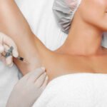 Can Botox Injections for Sweaty Glands Control Excess Sweat