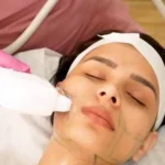 Does HIFU Treatment Help Define the Jawline