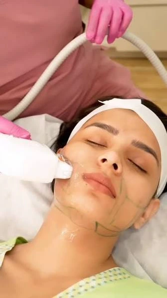 Does HIFU Treatment Help Define the Jawline