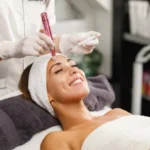 How Can Microneedling Treatment Improve Skin Tone