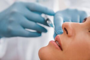 How Do Russian Lip Fillers Shape the Upper Lip