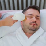 How Does Beard Laser Hair Removal Target Hair?