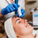 Is Fractional RF Micro Needling Effective for Acne Scars