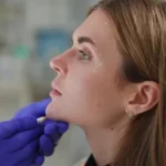 Is Jawline Fillers Suitable for Round Faces