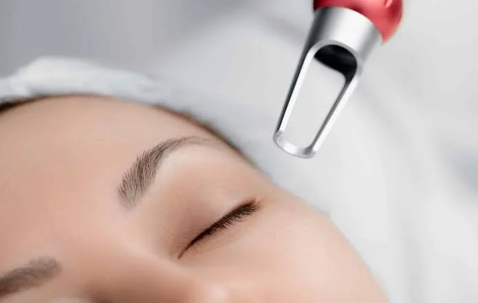 Is Pico Laser Treatment Suitable for Melasma