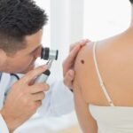 Moles-and-melanoma-a-mole-examination