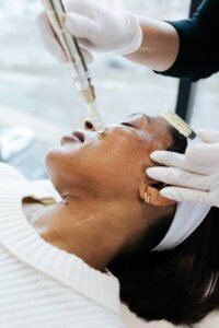 What Benefits Does Microneedling Treatment Offer