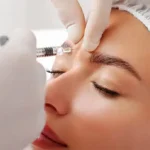 What Can Botox Do for Frown Lines