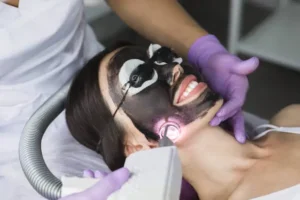 What Can Laser Carbon Peel Do for Acne