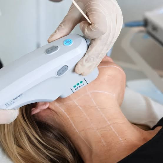 What Happens During Skin Tightening Treatment