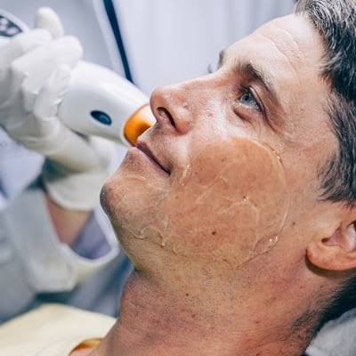 What Makes Pico Laser Treatment Effective