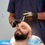 What are the key stages of FUE Hair Transplant recovery