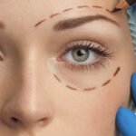 What are the main goals of modern Eyelid Surgery